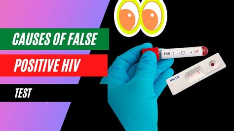 false positive hiv test causes